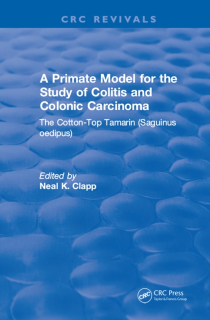 Primate Model for the Study of Colitis and Colonic Carcinoma The Cotton-Top Tamarin (Saguinus oedipus)