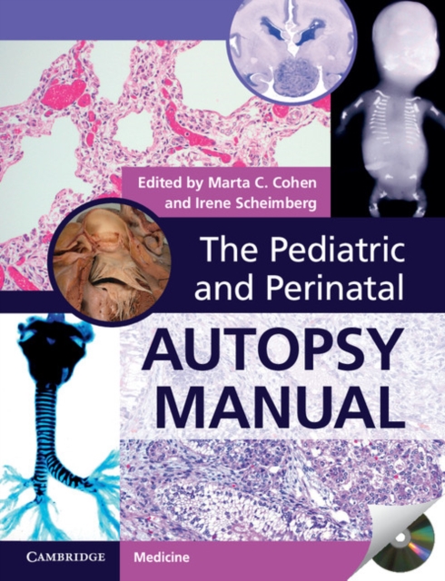 Pediatric and Perinatal Autopsy Manual