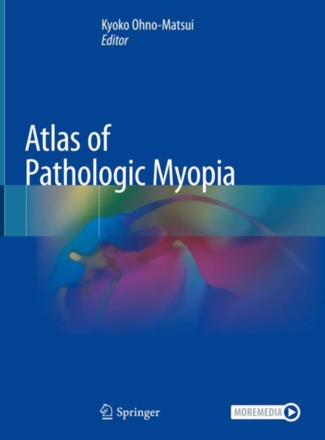 Atlas of Pathologic Myopia