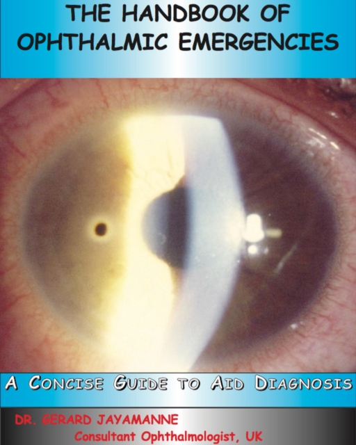 Handbook of Ophthalmic Emergencies