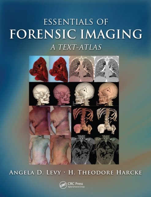 Essentials of Forensic Imaging