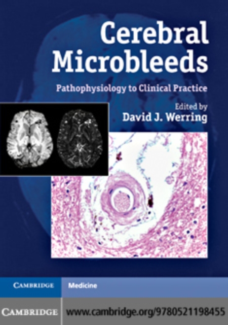 Cerebral Microbleeds