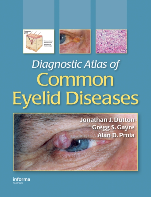 Diagnostic Atlas of Common Eyelid Diseases