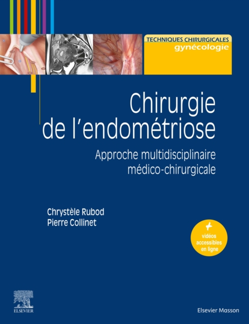 Chirurgie de l'endometriose