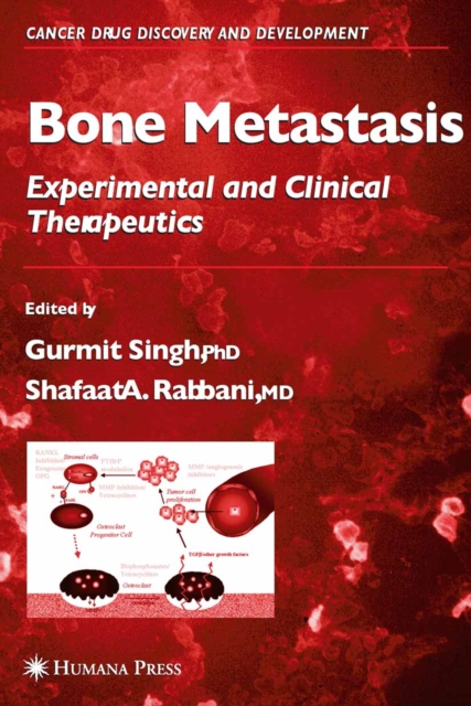 Bone Metastasis