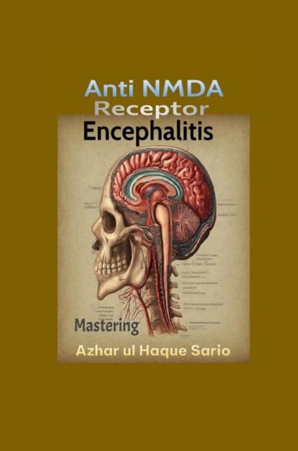 Mastering Anti NMDA Receptor Encephalitis