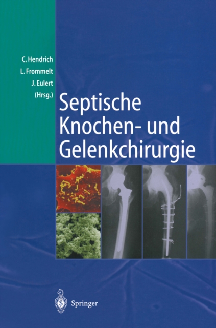 Septische Knochen-und Gelenkchirurgie