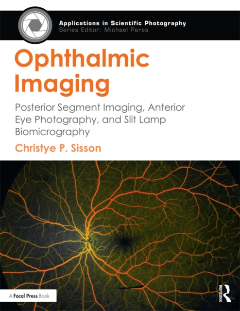 Ophthalmic Imaging