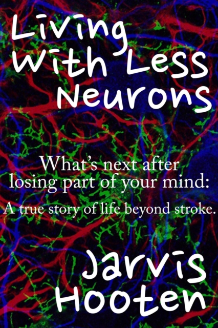 Living With Less Neurons