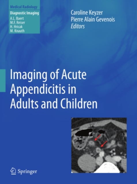 Imaging of Acute Appendicitis in Adults and Children