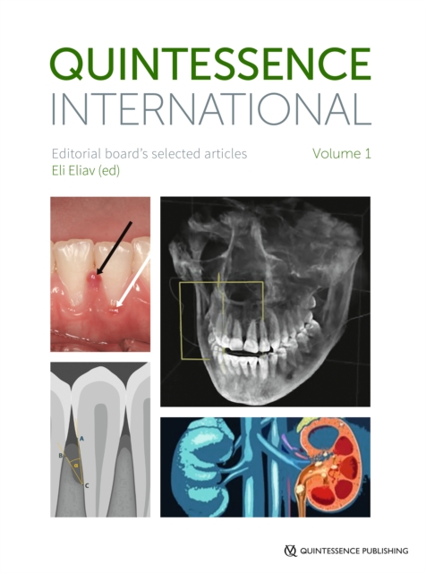 Quintessence International Volume 1