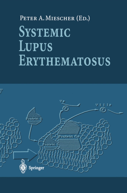 Systemic Lupus Erythematosus