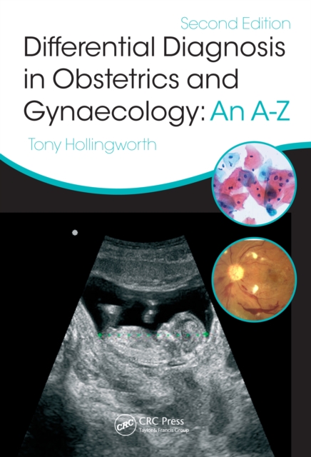 Differential Diagnosis in Obstetrics & Gynaecology