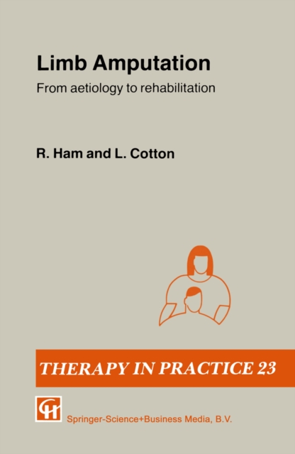 Limb Amputation