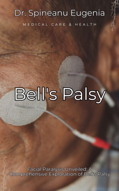 Facial Paralysis Unveiled: A Comprehensive Exploration of Bell's Palsy