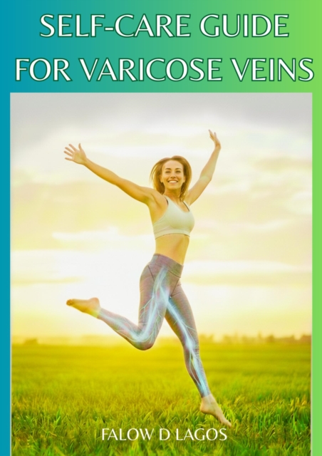 Self-Care Guide for Varicose Veins