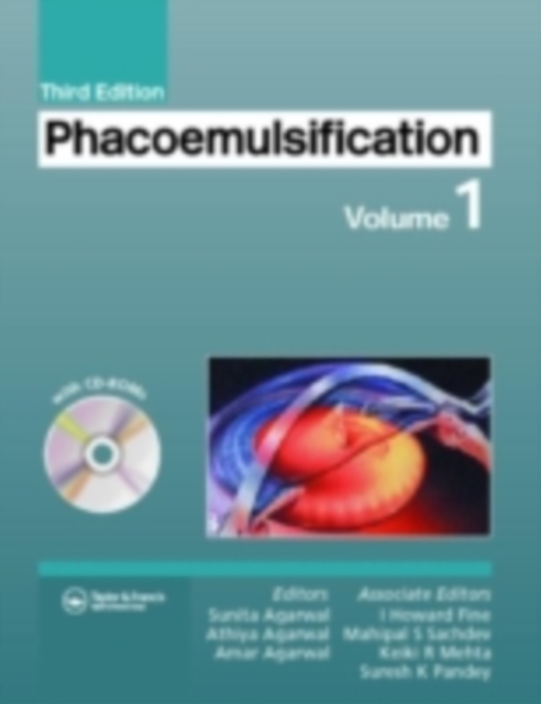 Phacoemulsification