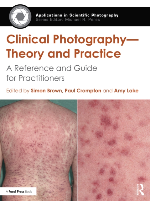 Clinical Photography - Theory and Practice