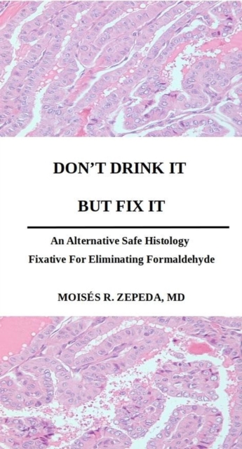 Don't Drink It But Fix It:  An Alternative Safe Histology Fixative For Eliminating Formaldehyde