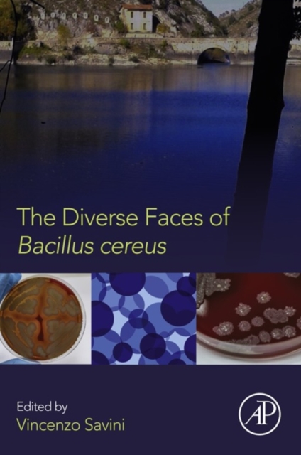 Diverse Faces of Bacillus Cereus