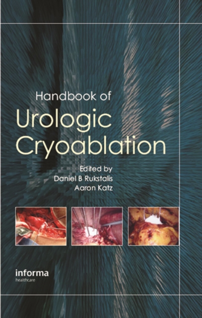Handbook of Urologic Cryoablation
