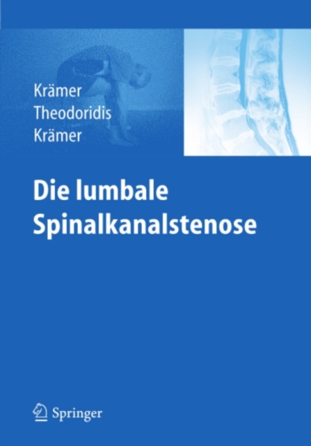 Die lumbale Spinalkanalstenose