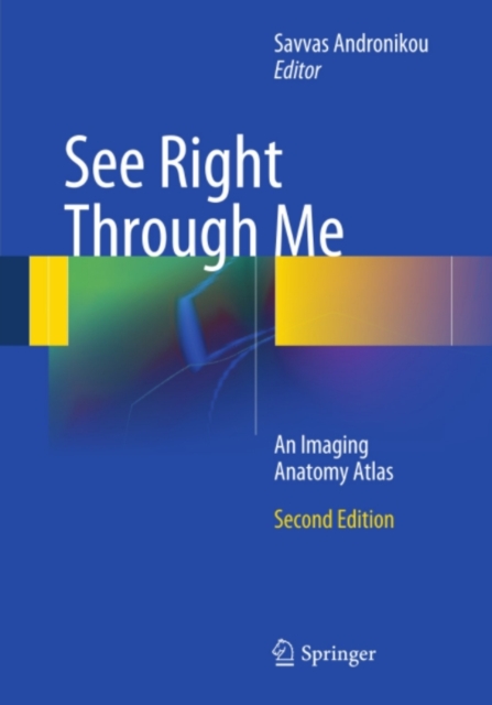 See Right Through Me