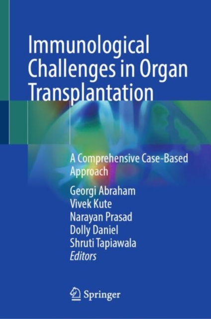 Immunological Challenges in Organ Transplantation