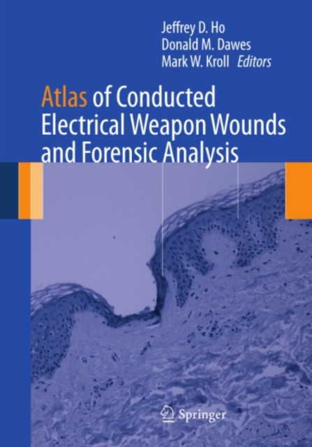 Atlas of Conducted Electrical Weapon Wounds and Forensic Analysis