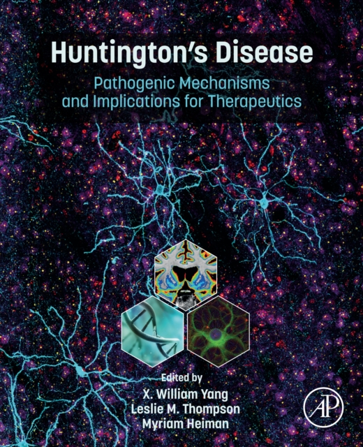 Huntington's Disease