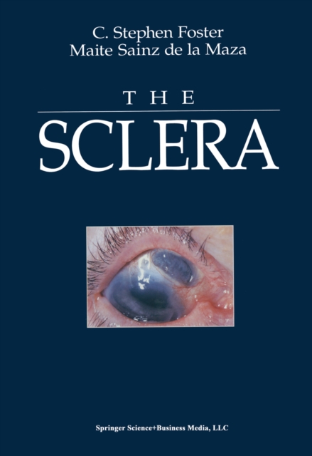 Sclera