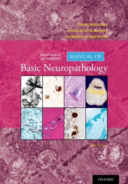 Escourolle and Poirier's Manual of Basic Neuropathology