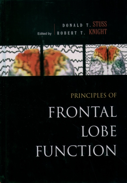 Principles of Frontal Lobe Function
