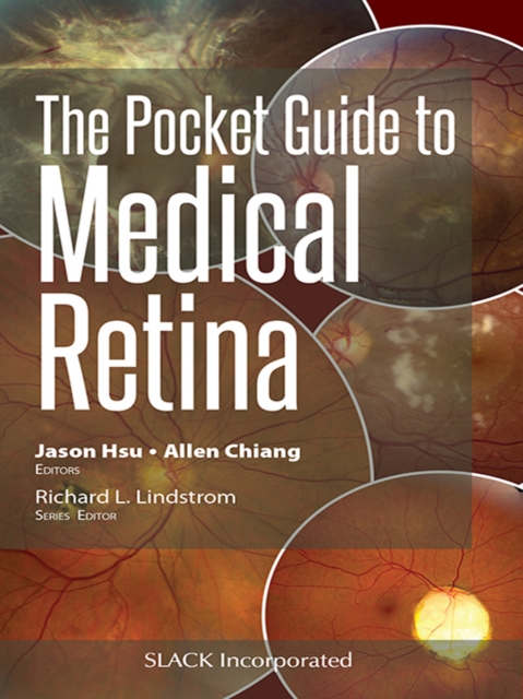 Pocket Guide to Medical Retina