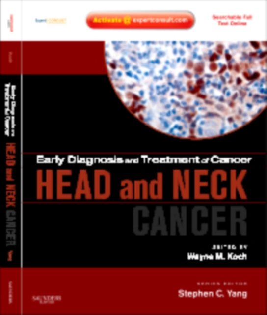 Early Diagnosis and Treatment of Cancer Series: Head and Neck Cancers E-Book