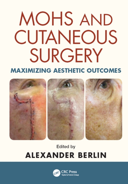 Mohs and Cutaneous Surgery