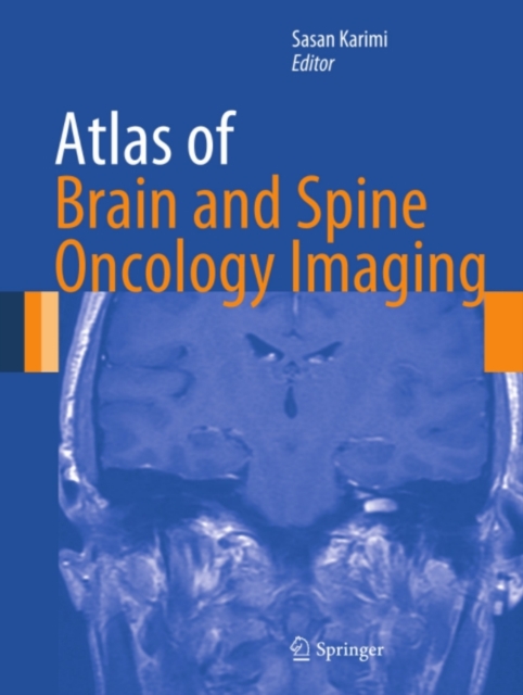 Atlas of Brain and Spine Oncology Imaging