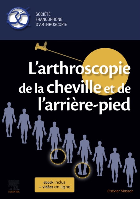 L'arthroscopie de la cheville et de l'arriere-pied
