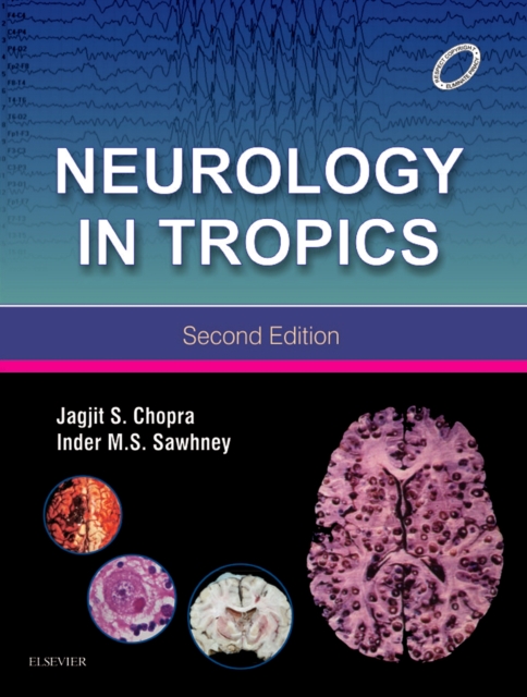 Neurology in Tropics (E-book)