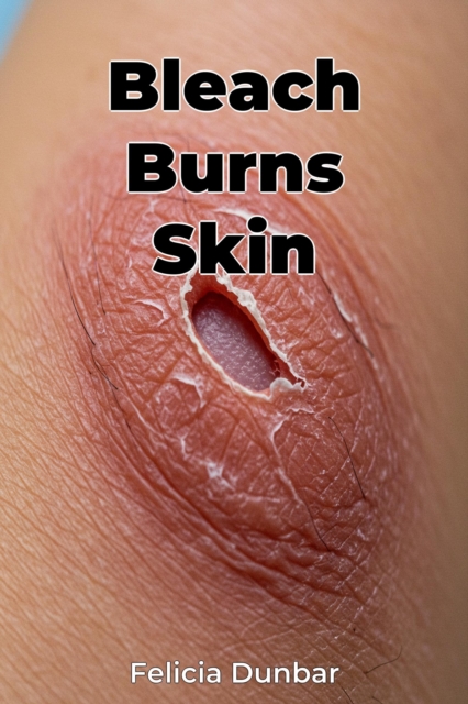 Bleach Burns Skin