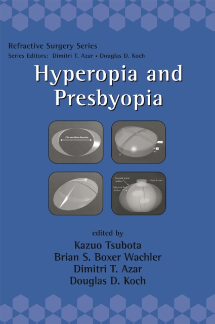 Hyperopia and Presbyopia