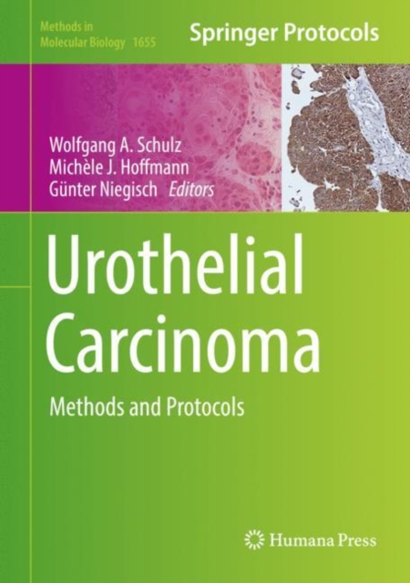 Urothelial Carcinoma