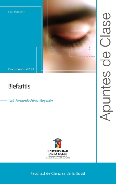 Blefaritis