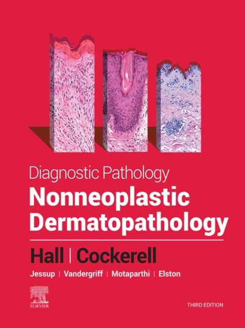 Update on Incidental Cross-sectional Imaging Findings, An Issue of Radiologic Clinics of North America, EBook