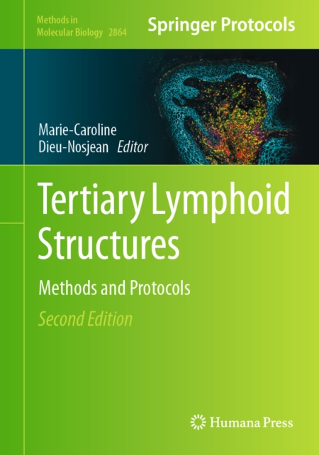 Tertiary Lymphoid Structures