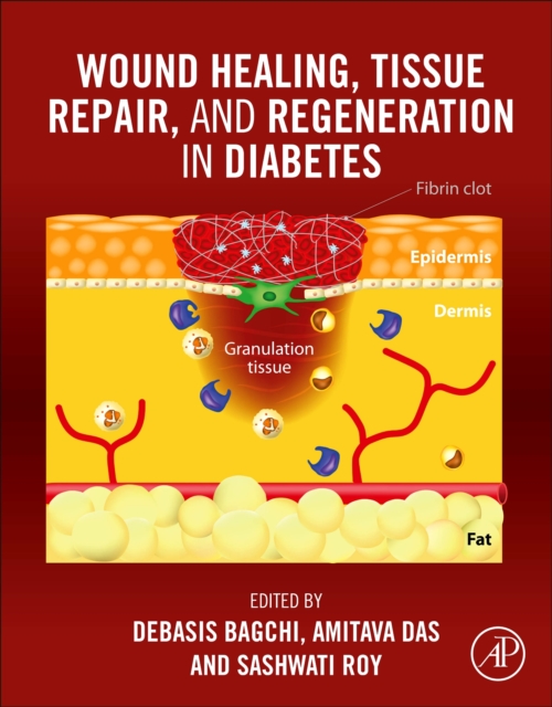 Wound Healing, Tissue Repair, and Regeneration in Diabetes