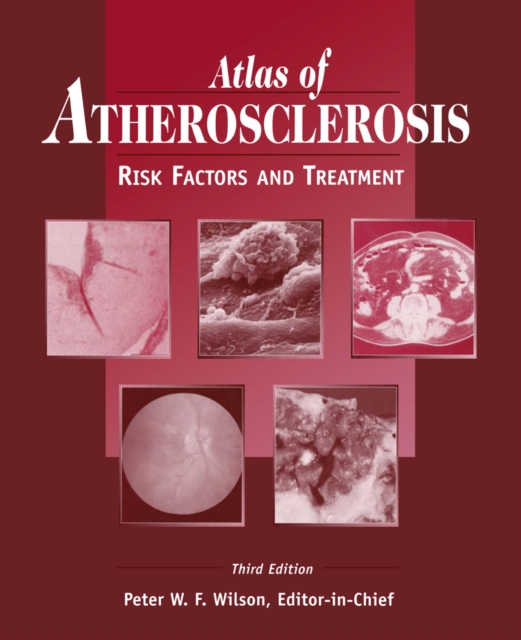 Atlas of Atherosclerosis