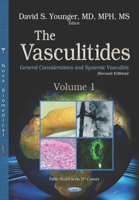 Vasculitides. Volume 1: General Considerations and Systemic Vasculitis (Second Edition)