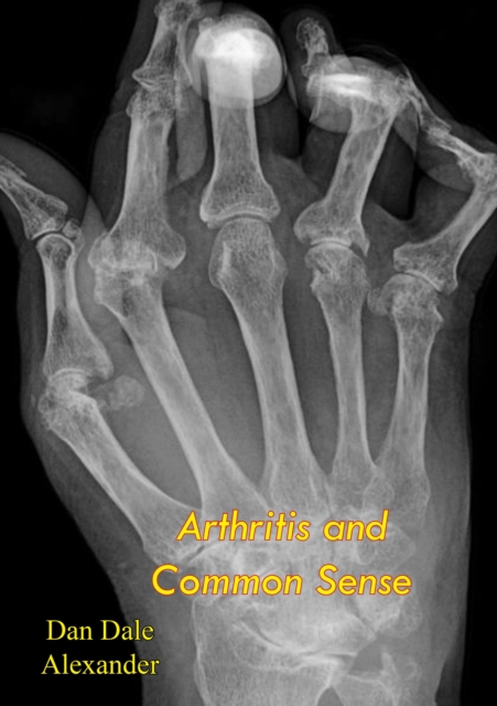 Arthritis and Common Sense