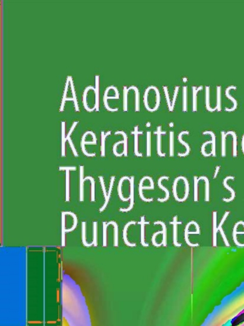 Adenovirus Epithelial Keratitis and Thygeson's Superficial Punctate Keratitis